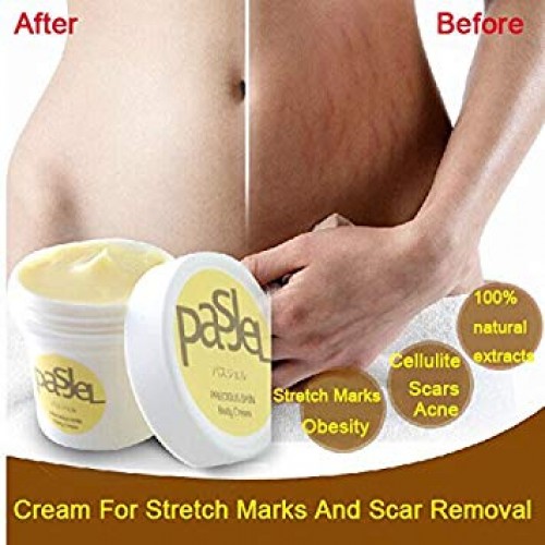PASJEL STRETCHMARK REMOVAL CREAM | Products | B Bazar | A Big Online Market Place and Reseller Platform in Bangladesh